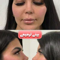 آف جراحی زیبایی ۱۹ میلیون