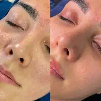 پاکسازی و فیشال میکاپ شینیون و کاشت مژه ورنگ|خدمات آرایشگری و زیبایی|مشهد, رسالت|دیوار