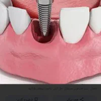 دستیارمطب دندانپزشک