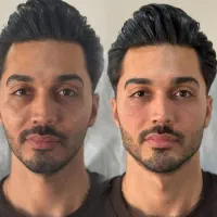 خدمات ژل بیکینی و زیر چشم و بوتاکس|خدمات آرایشگری و زیبایی|شاهین‌شهر, فردوسی|دیوار