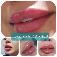 آموزش خدمات زیبایی  تزریق ژل .فیلر .بوتاکس .چربی|خدمات آموزشی|رشت, گلسار|دیوار
