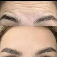 ژل .بوتاکس.انزیم،انواع پرسینگ با بهترین کیفیت.|خدمات آرایشگری و زیبایی|ملایر, |دیوار