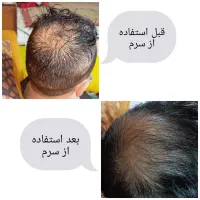 سرم ۱۰۰ درصد گیاهی مژه و ابرو|خدمات آرایشگری و زیبایی|مشهد, سناباد|دیوار