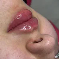 مرکز تخصصی افرینش لب روسی مادلینگ صورت بوتاکس و..|خدمات آرایشگری و زیبایی|اندیشه, |دیوار