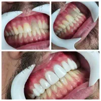 دندانپزشکی با پایین ترین قیمت و بالاترین کیفیت|خدمات آرایشگری و زیبایی|کرمانشاه, |دیوار
