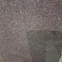 خرید فروش عکس رادیولوژی