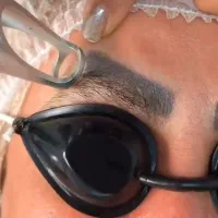 لیزر تتو های قدیمی تتوی صورت و بدن فقط ۵۰۰|خدمات آرایشگری و زیبایی|فولادشهر, C3|دیوار