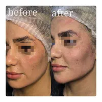 جشنواره تخفیف هفتگی ویژه نخ،مادلینگ فول فیس|خدمات آرایشگری و زیبایی|شاهین‌شهر, فردوسی|دیوار