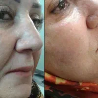 میخای بدونی چه محصولی پوستت رو صاف می‌کنه پیام