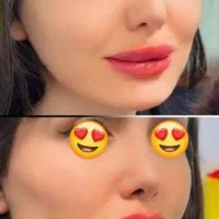 تزریق وآموزش ژل وبوتاکس  ۲۵۰۰ درکلینیک|خدمات آرایشگری و زیبایی|اهواز, بیست متری شهدا|دیوار