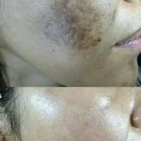 نمایندگی اصلی ضدلک لاکچری کوین|آرایشی، بهداشتی، درمانی|پاکدشت, پاکدشت (مامازند)|دیوار