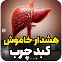 کبدچرب درمان شد *گیاهی*