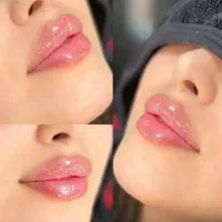 تخفیف ویژه ژل بوتاکس فیلر بادی مزوتراپی در مطب