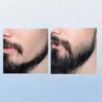 تغییر کن|آرایشی، بهداشتی، درمانی|لالجین, |دیوار