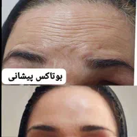 تزریق ژل بوتاکس تاتو پیرسینگ مژه و ...|خدمات آرایشگری و زیبایی|اهواز, پردیس|دیوار