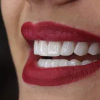 اگر امروز به دندانهایت توجه نکنی فردا دیره|خدمات آرایشگری و زیبایی|رفسنجان, |دیوار