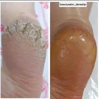 آموزش وخدمات کاشت ناخن کفسابی اپیلاسیون کوتاهی مو