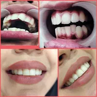 ارتودنسی لبخندی زیبا(فقط تا آخر ماه)|خدمات آرایشگری و زیبایی|مشهد, آزادشهر|دیوار