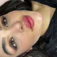 تزریق ژل و بوتاکس و چال گونه همراه با آموزش