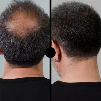 پودر پرپشت کننده مو مدل PREFECT ( رنگ مشکی