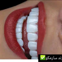 کامپوزیت دندان، روکش، دندانپزشکی تخصصی صدف تهرانسر|خدمات آرایشگری و زیبایی|تهران, تهرانسر مرکزی|دیوار