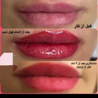 آرایش دائم صورت500تومان هزینه مواد|خدمات آرایشگری و زیبایی|دوگنبدان, |دیوار