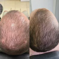 افزایش استحکام از ریشه