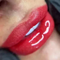 فیبروز ابرو ۱۵۰۰