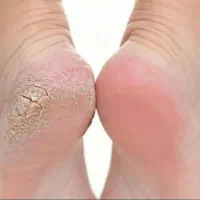 آفر امورش تضمینی و خدمات ناخن.پدیکور .پارافینتراپی|خدمات آرایشگری و زیبایی|مشهد, رضاشهر|دیوار