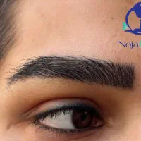 کاشت ابرو و شقیقه (طراحی نچرال)  قیمت قطعی