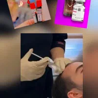 پی آر پی و مزوتراپی مو و ابرو