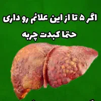 پاکسازی کبد چرب