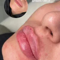 ژل لب|آرایشی، بهداشتی، درمانی|سبزوار, قصبه شرقی|دیوار