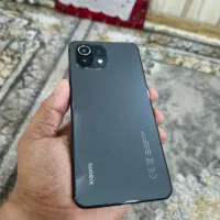 Xiaomi mi 11 lite