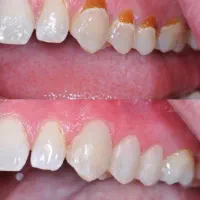 جشنواره یلدایی خدمات دندانپزشکی|خدمات آرایشگری و زیبایی|اردبیل, |دیوار