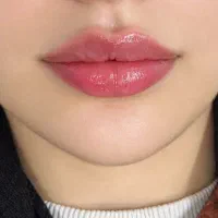 تخفیف فیلر و بوتاکس