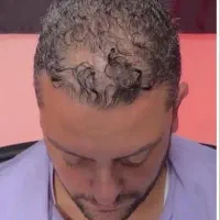 مشکل ارثی و ژنتیکی هم قابل درمانه