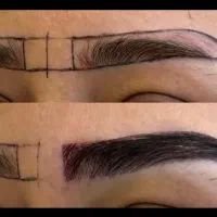 جشنواره یلدایی کاشت مو ، ابرو و مزوتراپی و prp|خدمات آرایشگری و زیبایی|زنجان, |دیوار