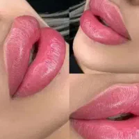 ژل و بوتاکس ،انزیم ،مزوتراپی شیدینگ لب