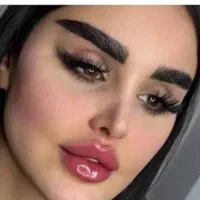 فیلر۳۹۰فیلربادی بیکینی بلفارولابیا،لیفت شقیقه.زگیل