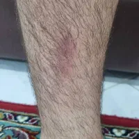 مشاوره درمانی|خدمات آرایشگری و زیبایی|شیراز, حافظیه|دیوار