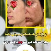 کرم دست و صورت