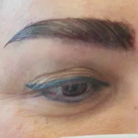 کاشت ابروی طبیعی و دائمی توسط تیم پزشکی|خدمات آرایشگری و زیبایی|تهران, زعفرانیه|دیوار
