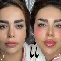 جشنواره ژل لب روسی فیلرزاویه بوتاکس مزو لیزرفیشیال|خدمات آرایشگری و زیبایی|شهریار, شهریار|دیوار