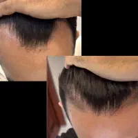 ریشه ریش هات با من