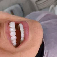 دندانپزشکی، لمینت،ایمپلنت ،دیجیتال،نقدواقساط|خدمات آرایشگری و زیبایی|مشهد, سناباد|دیوار