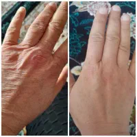 جوانسازی کرم دست