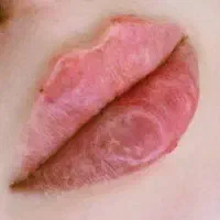 تزریق و آموزش خدمات ژل و بوتاکس و کراتین مو|خدمات آرایشگری و زیبایی|هشتگرد, شهرک اداری|دیوار