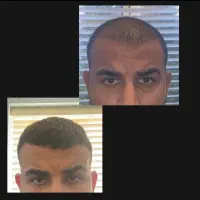 نه به کچلی
