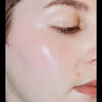 کرم سفید کننده صورت و بدن سفیدی بدون بازگشت